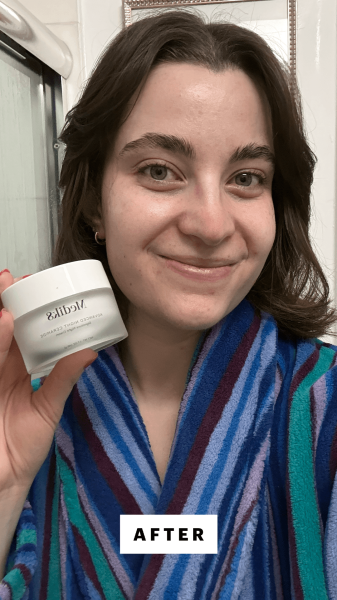 Felbin after applying the Medki8 Advanced Night Ceramide Night Cream