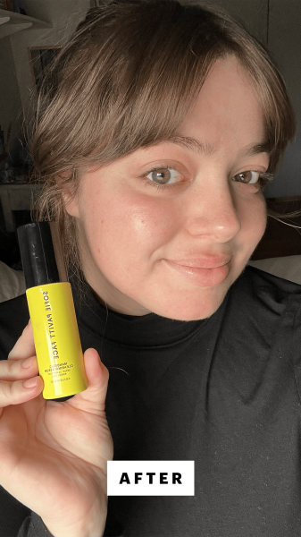 Hoffmann after applying the Sofie Pavitt Face Mandelic Clearing Serum