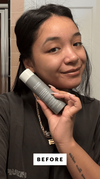 Richards before applying the Paula's Choice 6 Mandelic Acid  2 Lactic Acid AHA Liquid Exfoliant